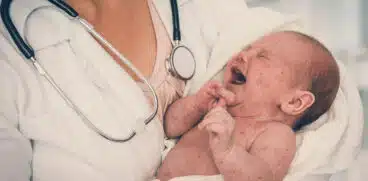 Ministerul Sănătății a declarat epidemie de rujeolă în România. Sunt aproape 2000 de cazuri la nivel național | Demamici.ro