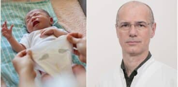 Iritația de scutec și iritațiile pliurilor cutanate – interviu cu Conf. Dr. Cătălin Popescu VIDEO (P) | Demamici.ro